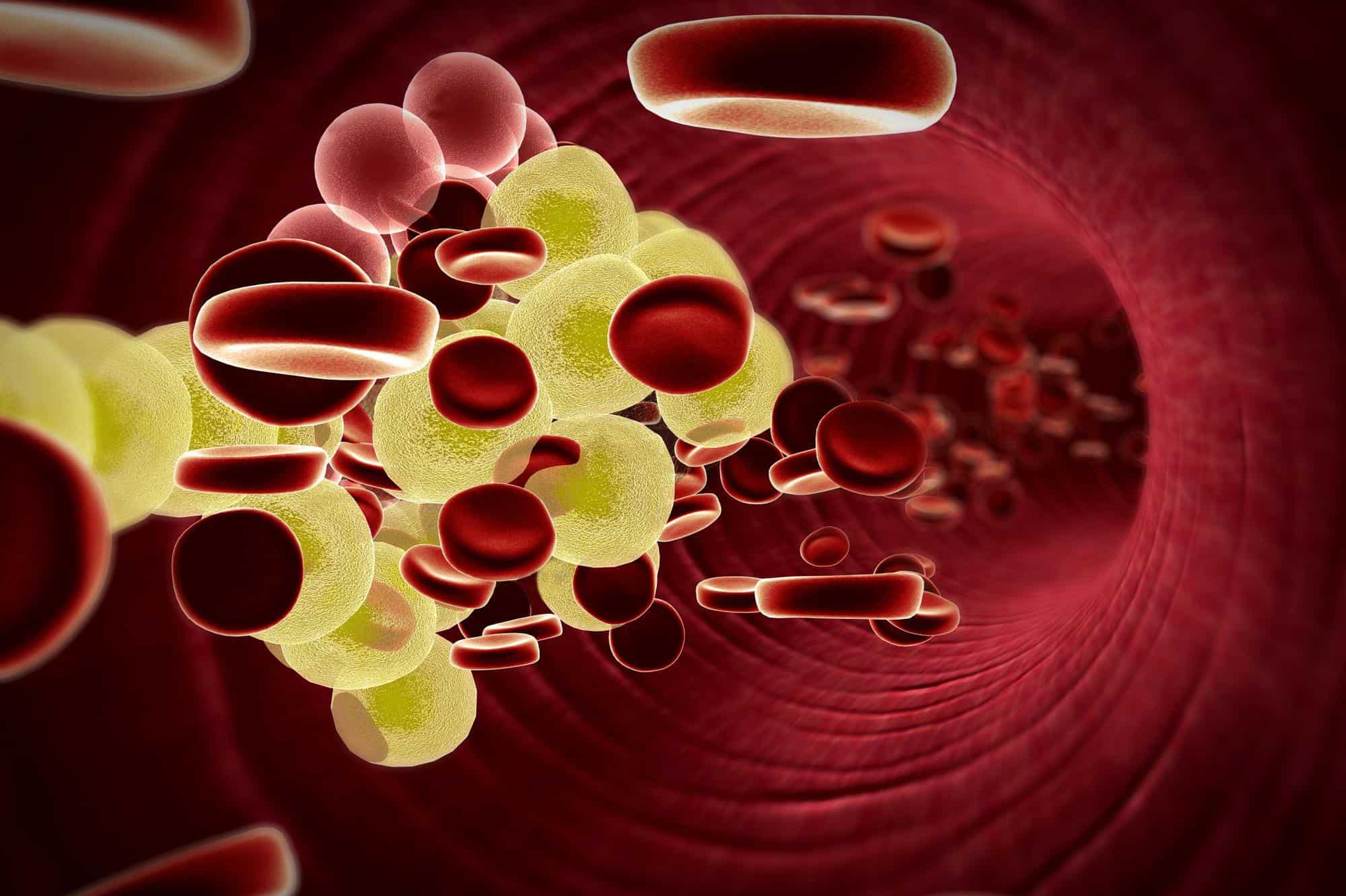 كوليسترول في الدم