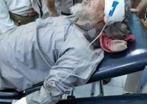 إصابة الذراع الأيمن للفريق علي محسن الأحمر واليد الطولى للإصلاح في مأرب