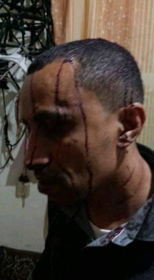 المواطن محمد شمسان بعد ضربه والاعتداء عليه